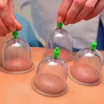 بادکش بدن مدل K.M دستی بهمراه 6 لیوان - Image 14